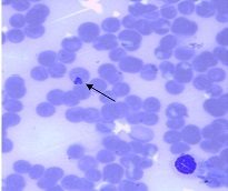Frotis sanguíneo con cuerpos de inclusión compatibles con Babesia caballi en el interior de eritrocitos